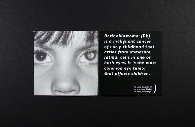 Retinoblastoma Brochure